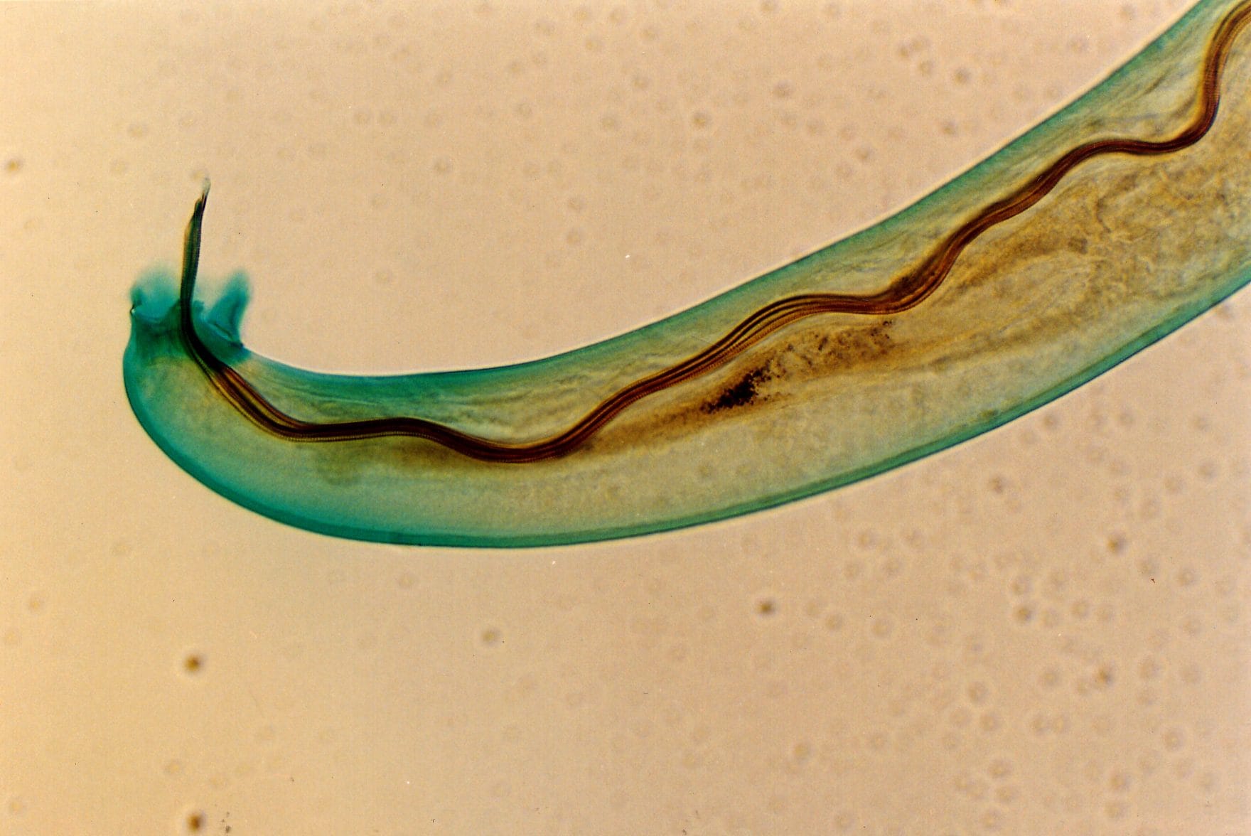 Angiostrongylus_cantonensis_Male