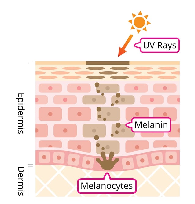 Melanin melanocytter soling