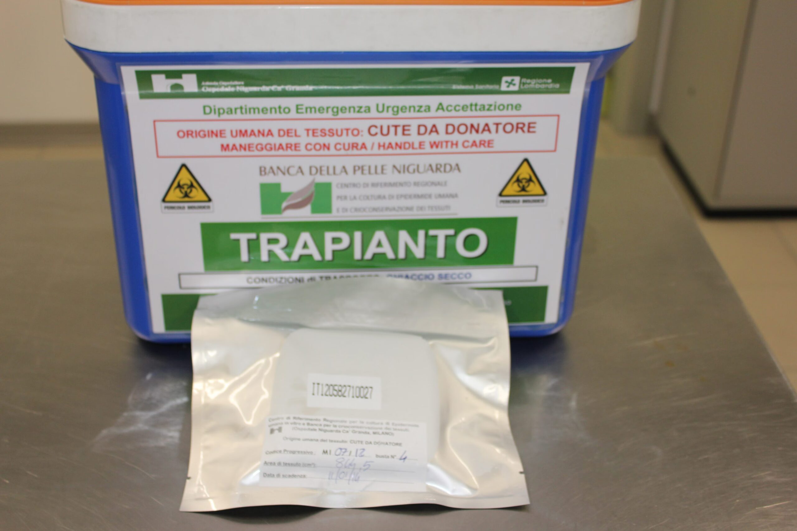 intervju med ekspertene fra Niguarda Tissue Bank