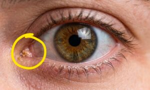 hva cips er og hvordan de dannes