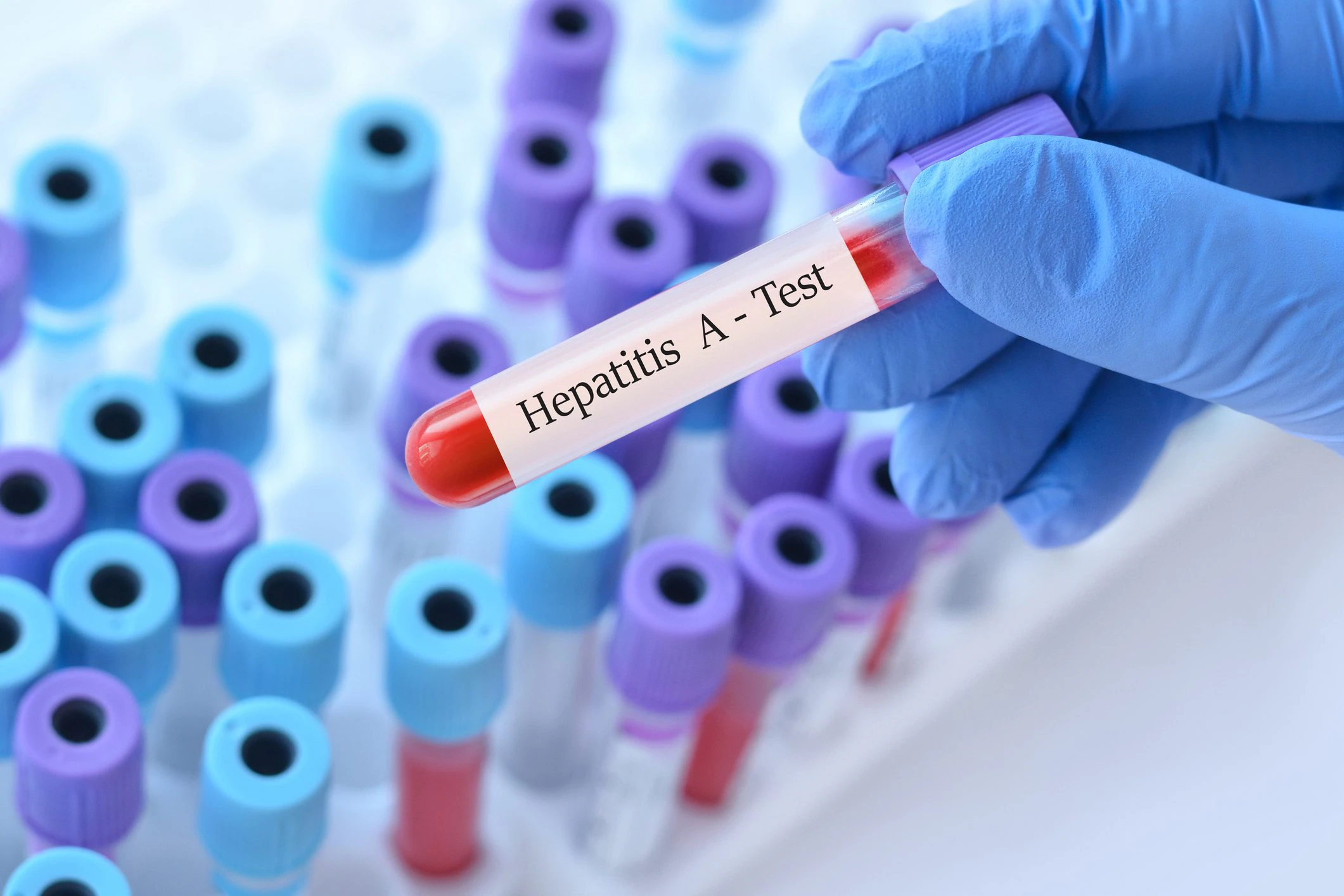 hva ISS sier om viruset og smitteforebyggende tiltak