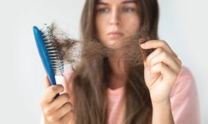 Hvorfor mister vi håret? Alt du trenger å vite om alopecia