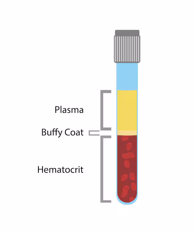 hematokrit