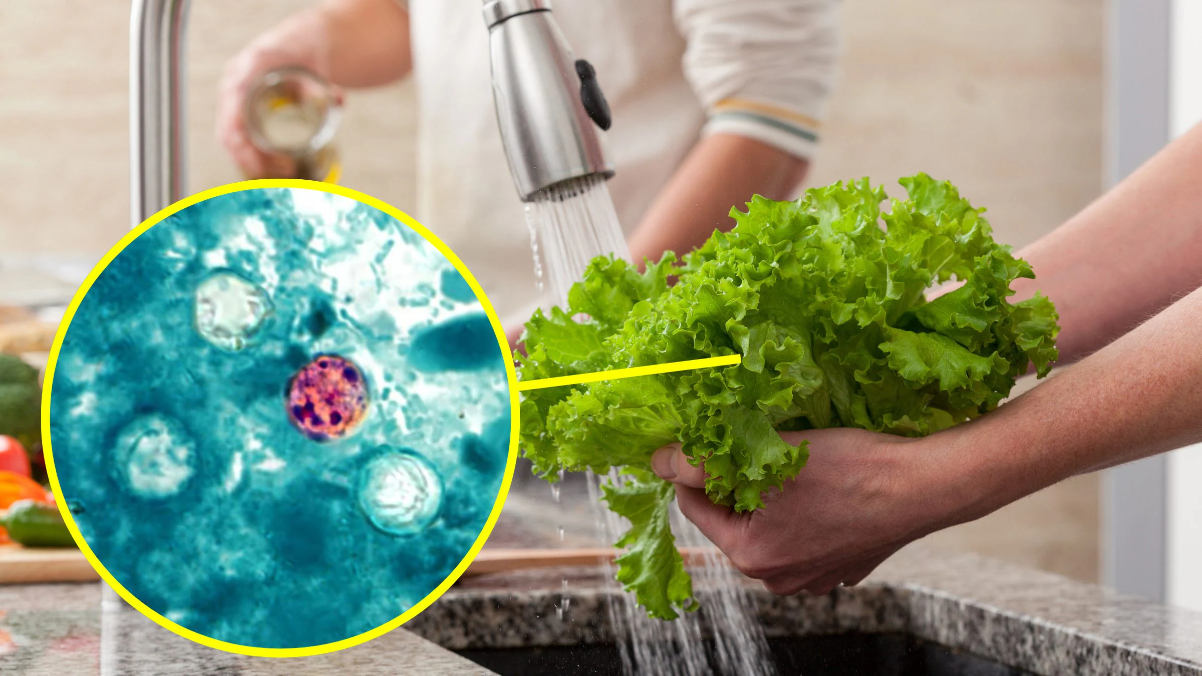 Cyclosporiasis i USA, infeksjoner på vei opp: hva er infeksjonen forårsaket av parasitten som forurenser mat